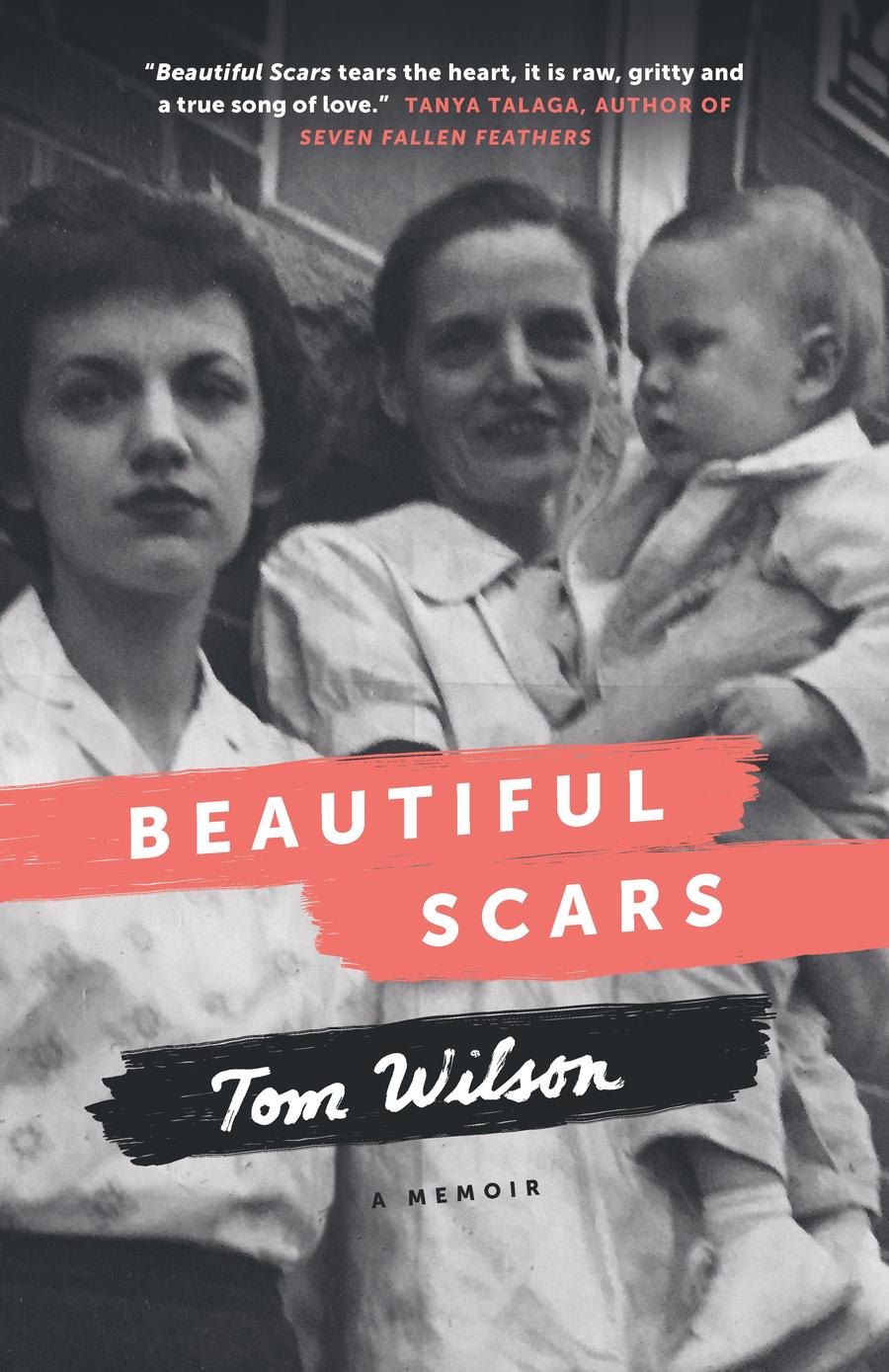 Beautiful Scars-Memoirs-買書書 BuyBookBook