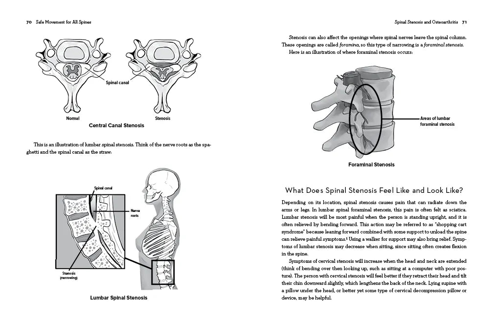 Safe Movement for All Spines US - Paperback / softback
